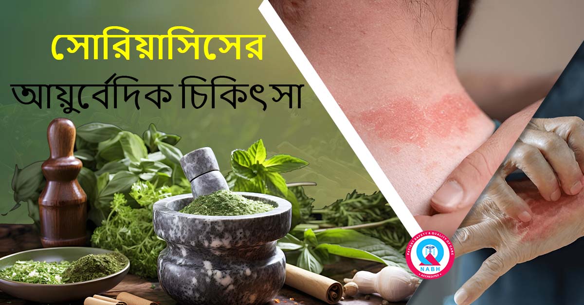 ayurvedic-treatment-for-psoriasis